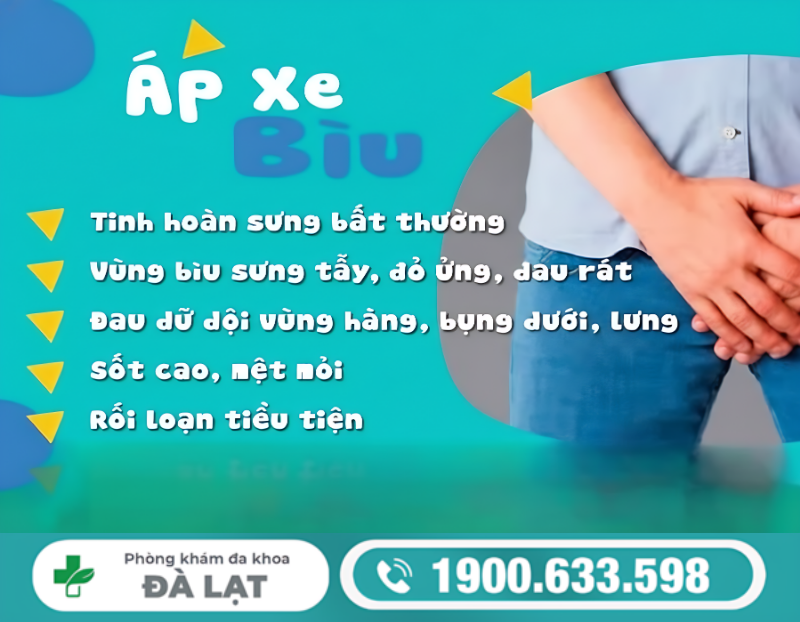 Hình ảnh minh họa